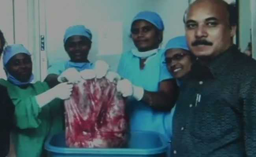 ovarian 12